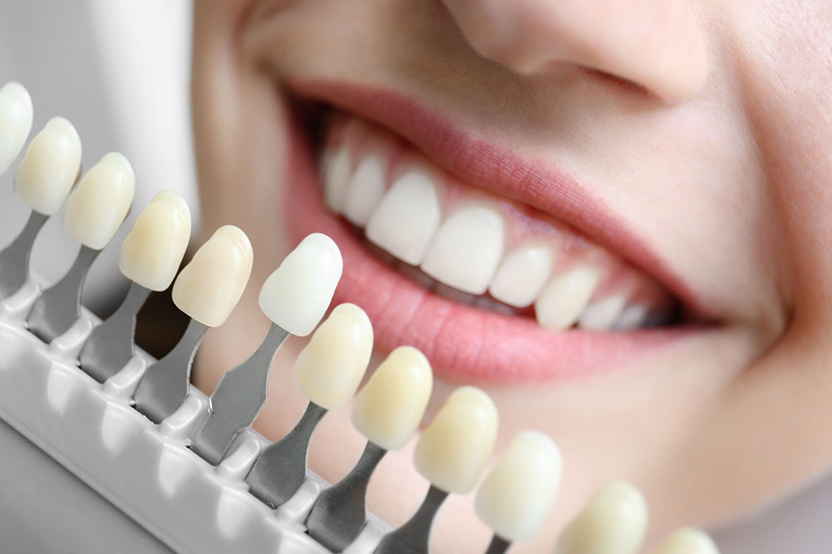 Dental implants in Toronto at Parliament Street Dentistry