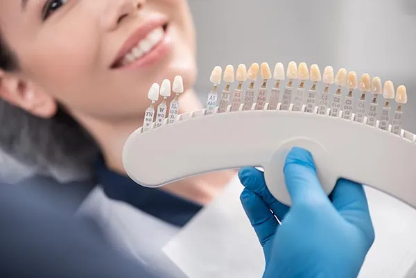 Cosmetic dental bonding shade matching at Parliament Street Dentistry, Toronto