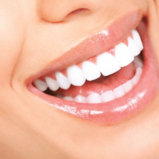 Close-up of a healthy, bright smile after dental care